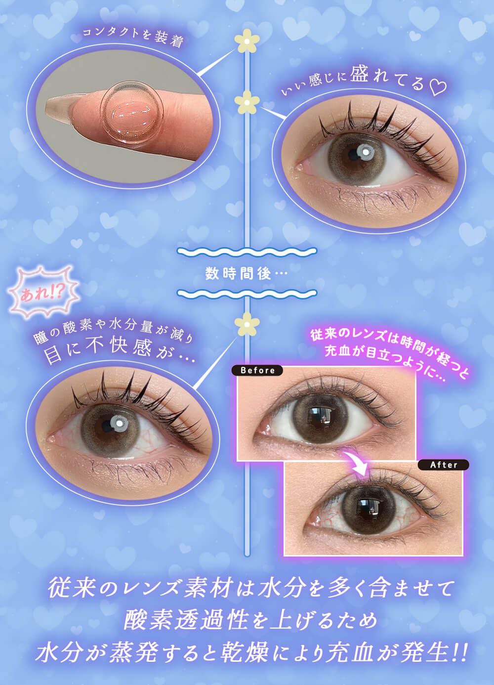 従来のレンズは酸素透過性を上げるため蒸発すると乾燥により充血が発生