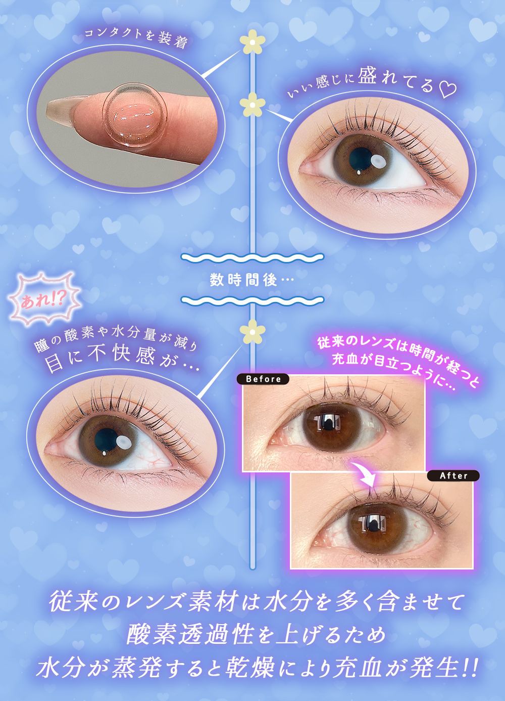 従来のレンズは酸素透過性を上げるため蒸発すると乾燥により充血が発生