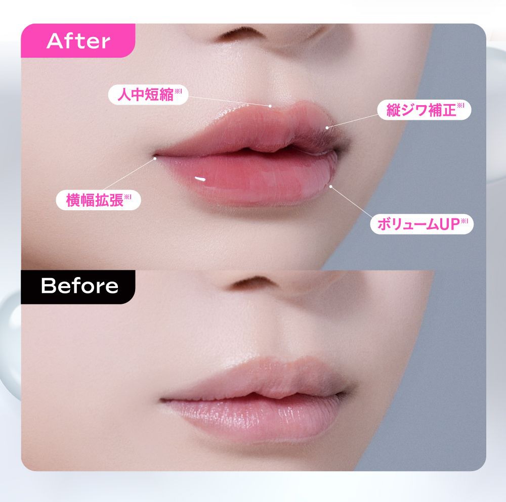 ビフォアフ